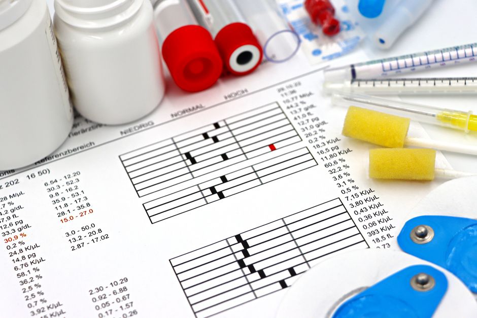 Medical equipment, lab tests, and health data arranged on a clinical table.